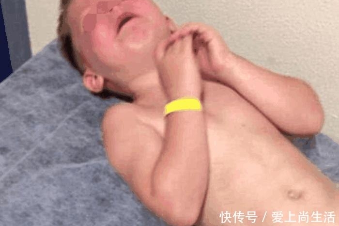 小男孩游泳完下体发生疼痛,脱下裤子后,妈妈吓呆了
