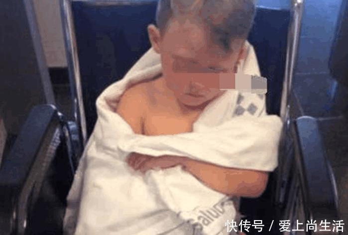 小男孩游泳完下体发生疼痛,脱下裤子后,妈妈吓呆了
