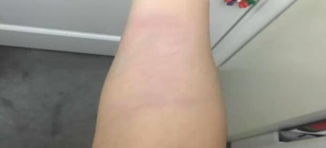 女子叫来网约车 不料司机逼其消单还车窗夹其手