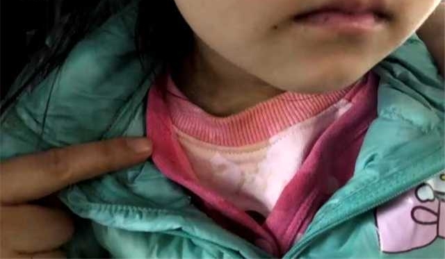 ��͵����������ڽ� �������ȿ�������3��Ůͯ