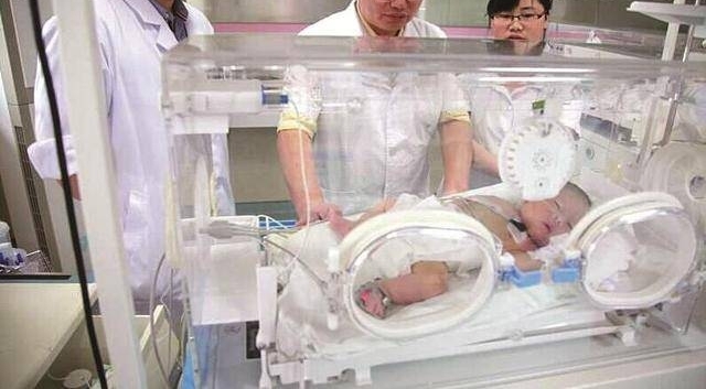 出生10天女婴肚子胀鼓鼓,医生开腹手术后又剖出两娃