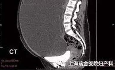 ����Ů�Ǵ����и�����Ϊֻ�ǳ����ˣ�һ�����ҽ���������ˣ�