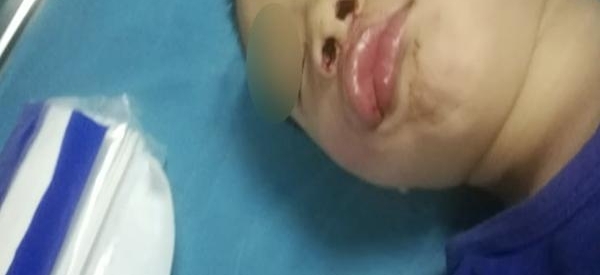 ��ͯ��ײ��׳�����߷�һ��Զ ­�ڳ�Ѫ��������