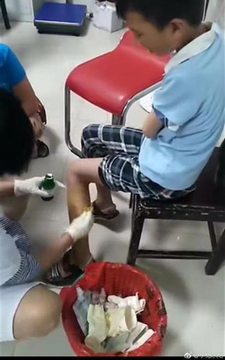 ����һ�����Ʒ蹷ҧ��28�� ȫ��׷����δץ��