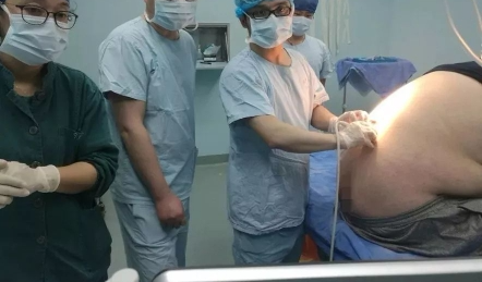 杭州27岁IT男得的这个怪病 一推进手术室惊呆医生