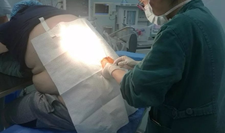杭州27岁IT男得的这个怪病 一推进手术室惊呆医生