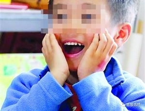 6岁男童幼儿园噎食窒息 事发后曾在孩子气管中取出一块异物