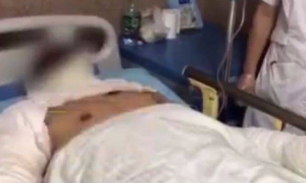 吓人!天然气泄漏传异味,张家界8岁女童用打火机照明引发爆燃!