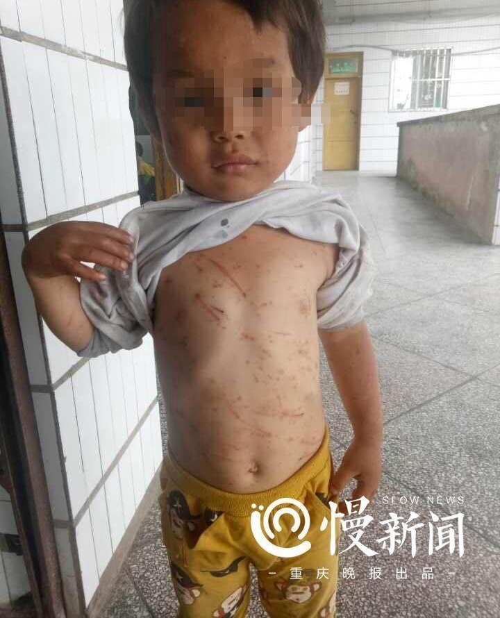 因为儿子没有给生活费 重庆垫江5岁男孩被亲奶奶毒打致昏迷