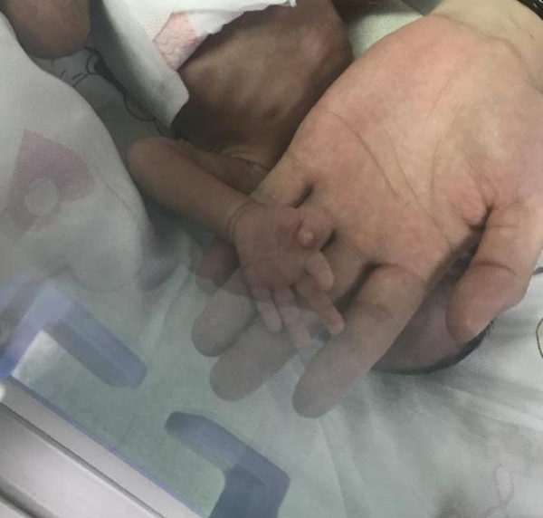 ���������Ӥ��ΣסԺ �Ǽ�����Ϊ17��ĸ�ĸʧ��