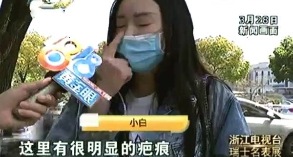 看眼却被填“夫妻宫”,离婚后额头出现大量肿包,医院:找卫生局