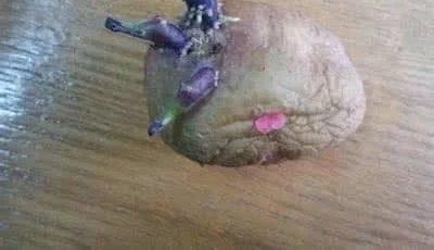 女子突然肚子疼,送去医院检查发现肚子有异物,取出一看所有人惊呆了
