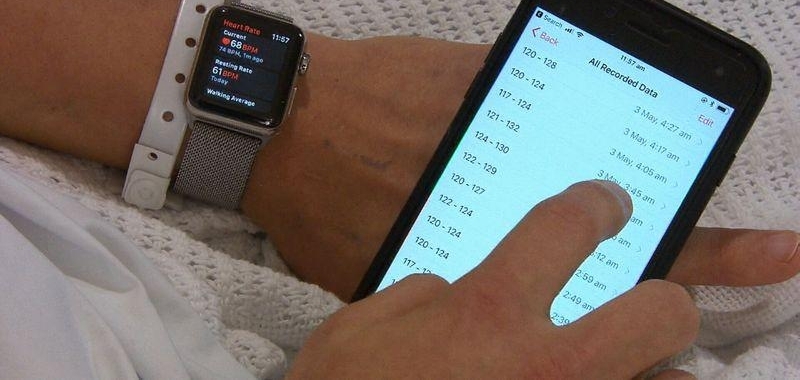 Apple watch���������ʼ�ⷢ���쳣�����������