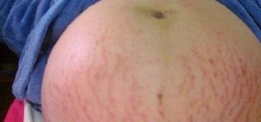 ������������̥����֪�����Ա�󣬱���˵�Լ��ϱ�������������ϵ
