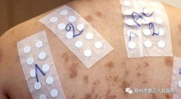 ����Ժ�����ա�Ƥ�����Ƿ���������ȥ��һ�����ԭ��