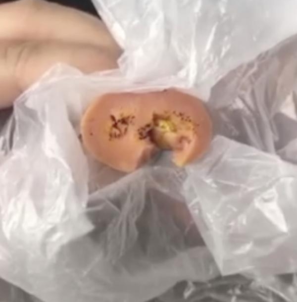 ��������ʳ����ĩ������ȳ����� ������ΪͶ��