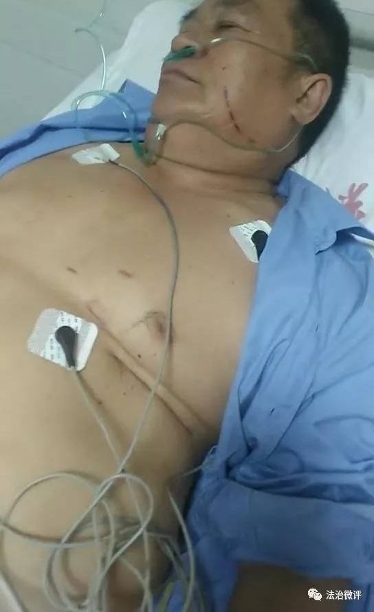 �������ܣ� �����붽����ٱ���Դ����εĴ��񱻵��ֱ���������Σ