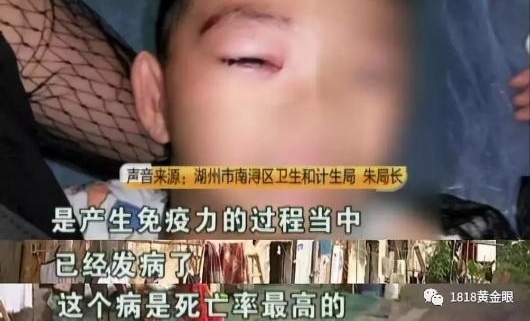 6岁男童被狗咬13天后去世 离打第四针狂犬疫苗差两天