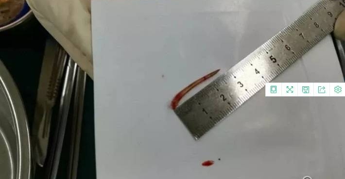 ������Ϊ3���׵���̿����أ���ǰ�Ѵ���ʳ�ܽ����������ǻ����