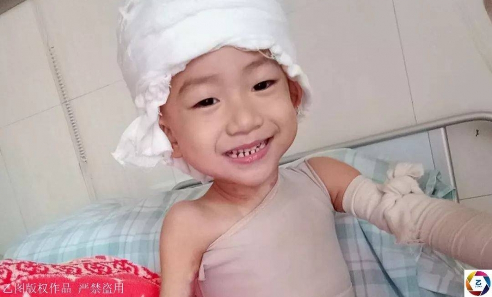 女子信习俗,坐月子泡药水澡,刚转身2岁女儿就跌进开水盆,崩溃