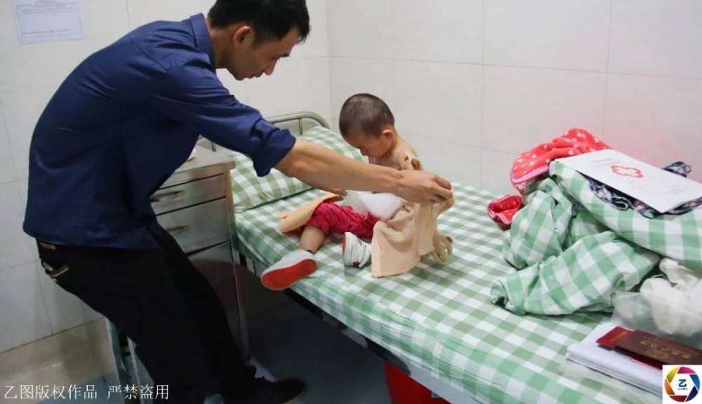 女子信习俗,坐月子泡药水澡,刚转身2岁女儿就跌进开水盆,崩溃