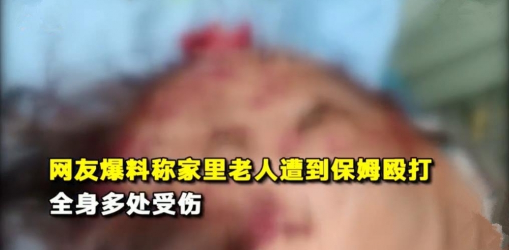 Ҿ徣83˱ķסԺ ֻΪƵҹ