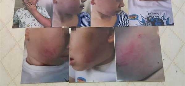 �Ա�֢�������Ͼ������� �����������˴��һ��