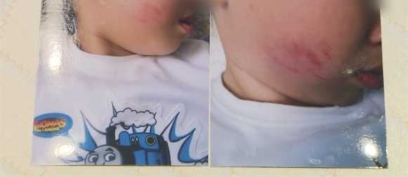 �Ա�֢�������Ͼ������� �����������˴��һ��