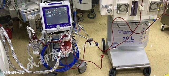 53岁男子自主呼吸心跳停止80分钟 竟然又活了过来!