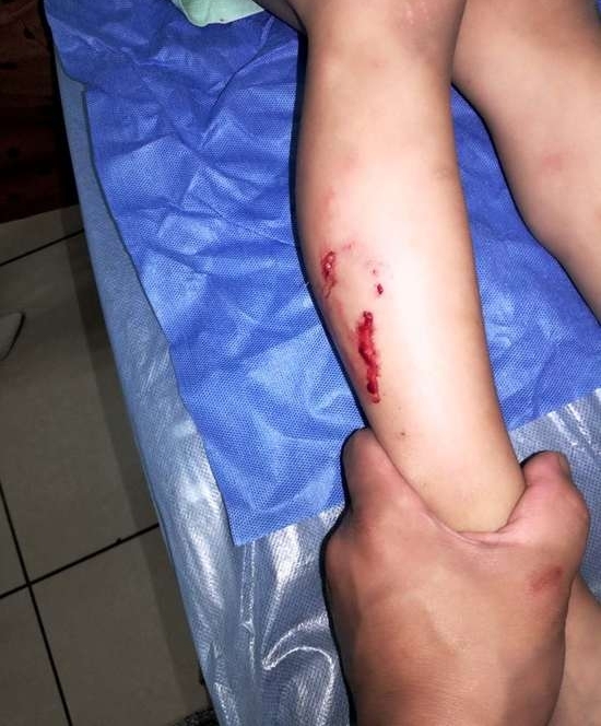 ��ͯ����ҧ�˺��Ȯ�������� ������ֻ˵:�����߰�