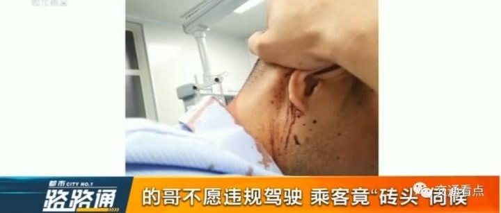 又一起的哥被打事件,起因只是不愿违规行驶