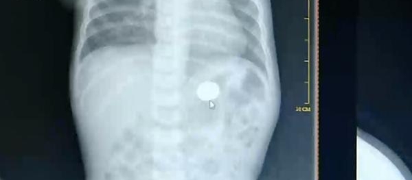 1Ӥˤϸ첲Ժ ҽȴ˵ҲҪ