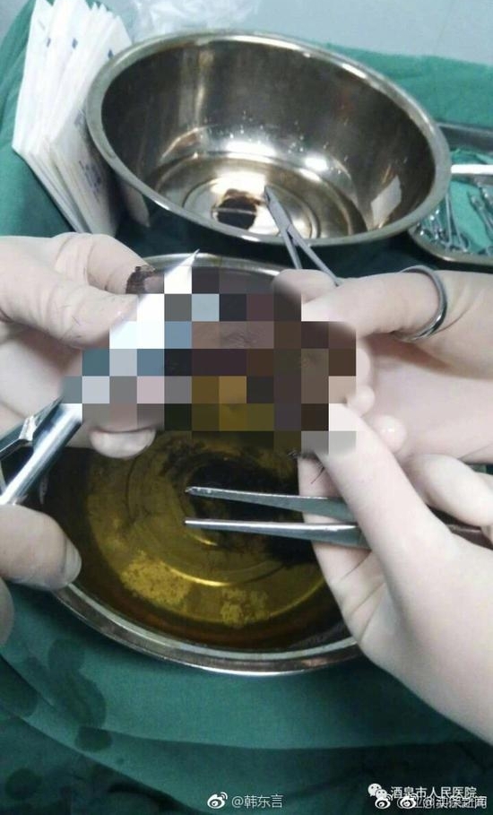 ��ͯͷƤ����˺�� ҽԺ����Ѫ��ͼ��������Ȯ����