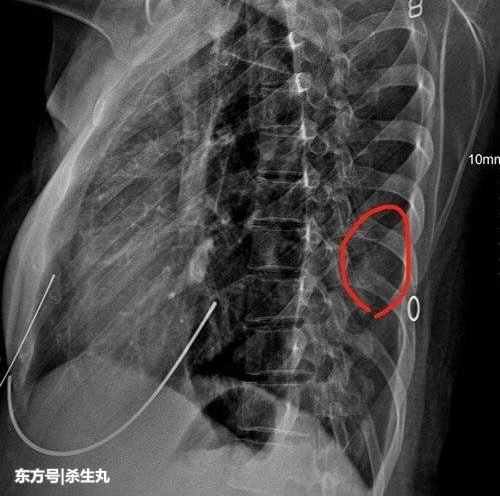 �ټ�������Ů˾������ʱ��һ���� ����߹Ǳ����ȶϡ���