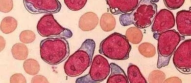 һסԺƣͬſû뵽С˼