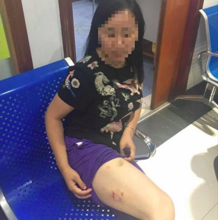 ���Ӵܽ�����ң�ҧ��2��Ůͯ ���������ߵ���