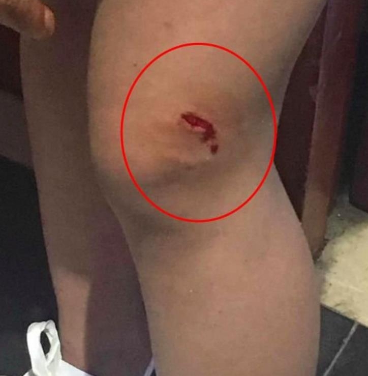 ���Ӵܽ�����ң�ҧ��2��Ůͯ ���������ߵ���