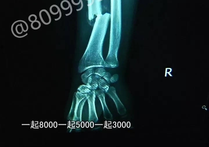 ������ע�⣡���������������������С��챨����