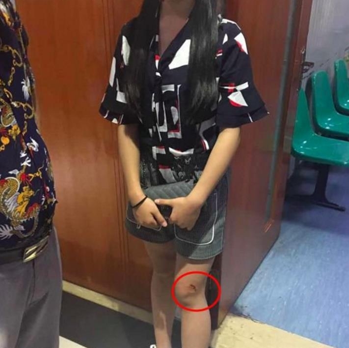 ���Ӵܽ�����ң�ҧ��2��Ůͯ ���������ߵ���