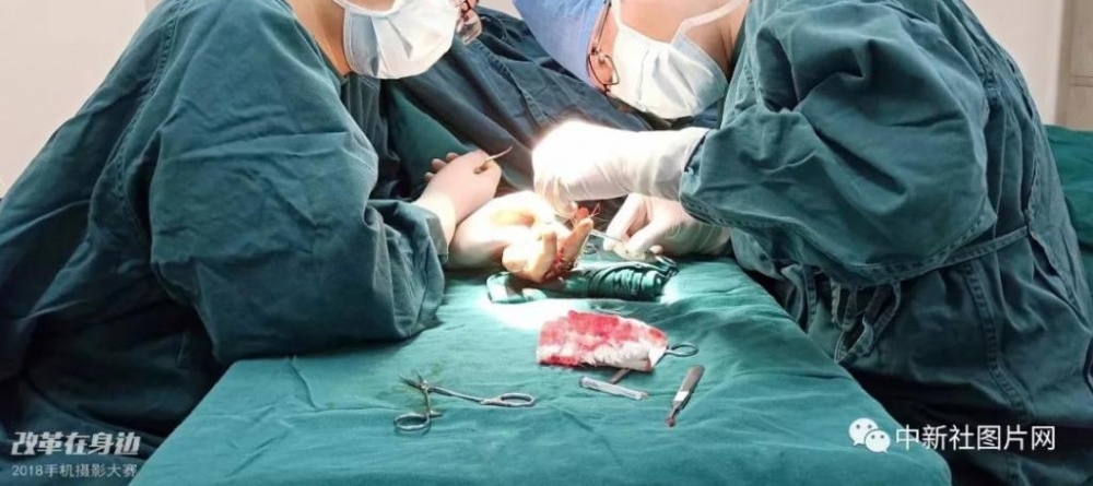 �ĸ￪������2018�ֻ���Ӱ�����������ܽ���¯��