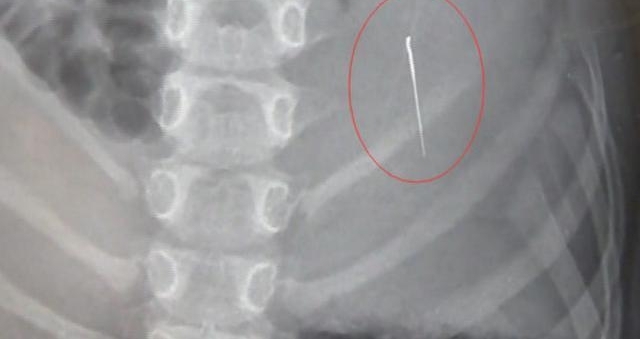 ȥҽͻȻͣܳȥˣ޷ԭҽԺ