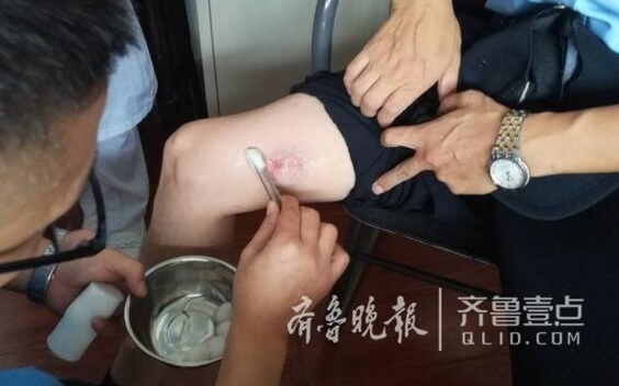 Ů���ڼ���ĳҽԺ��ҧ���񾯴��� ������6����