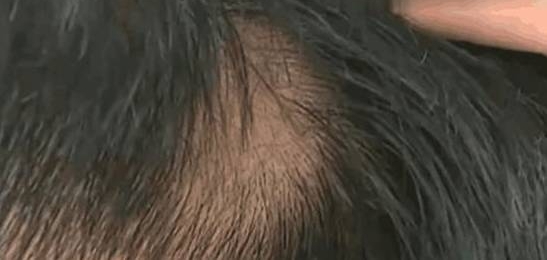 ȥ5000Ԫ ֱƭҪǮ 곤Э鲻